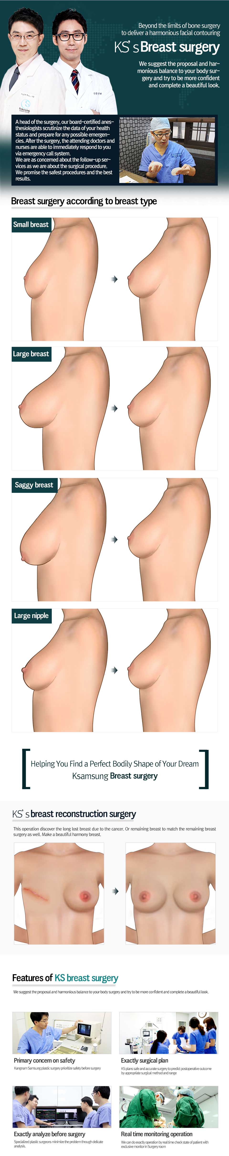 Breast Augmentation Surgery For Saggy Breasts? – Eunogo